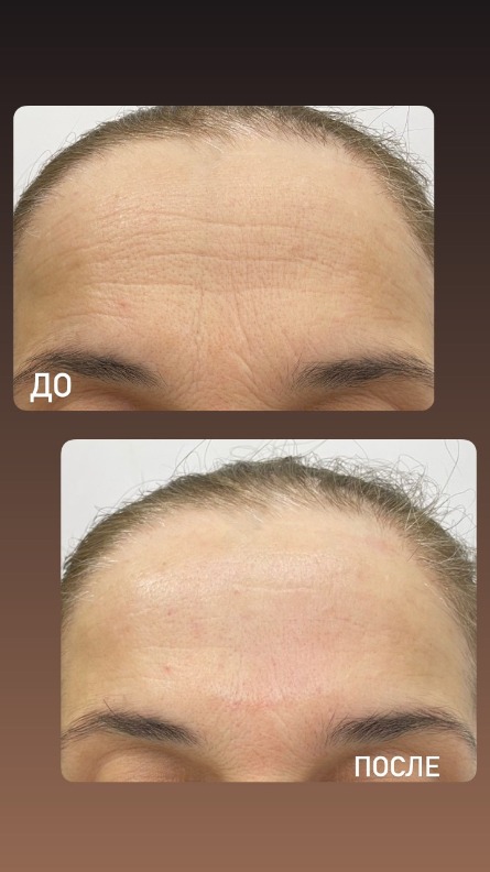 Авторский массаж лица