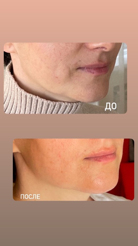 Авторский массаж лица