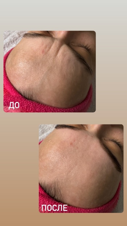 Авторский массаж лица