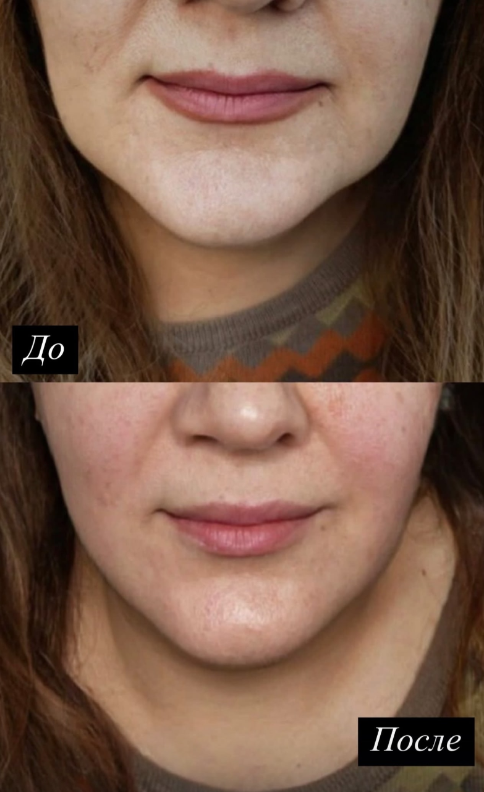 Авторский массаж лица