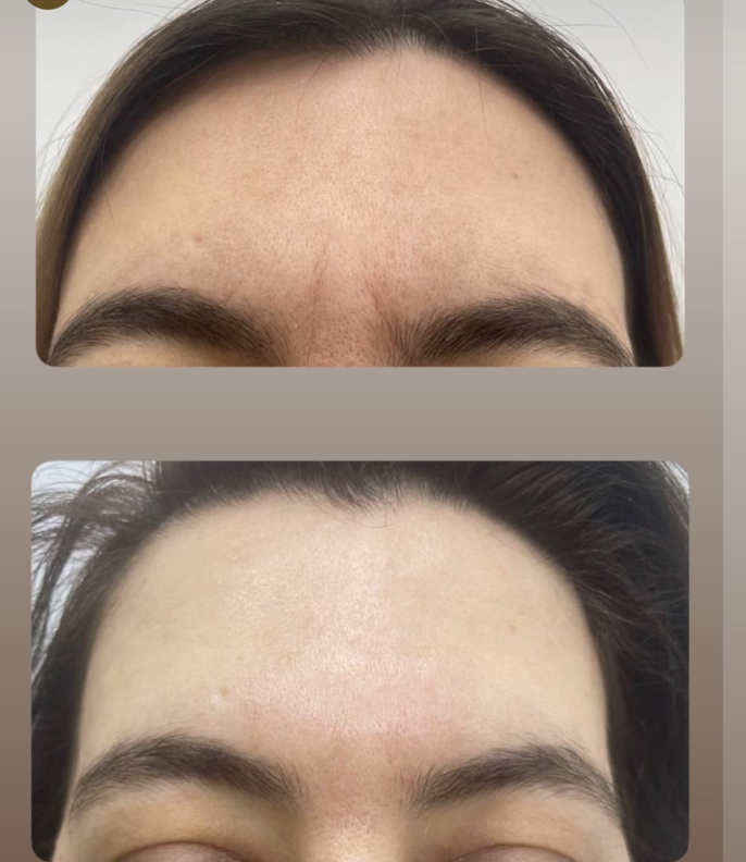 Авторский массаж лица