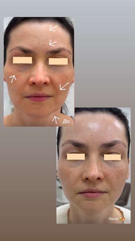 Авторский массаж лица