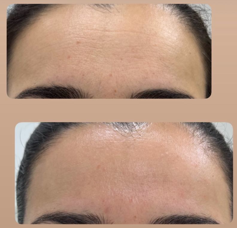 Авторский массаж лица